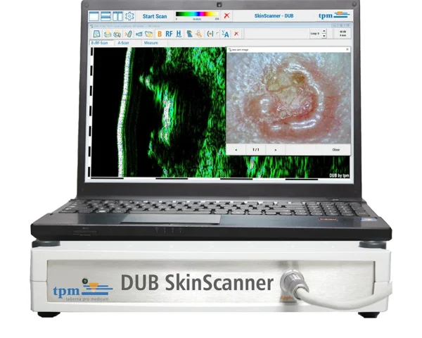 Multi Frequency Ultrasound Skin Scanner DUB System 75